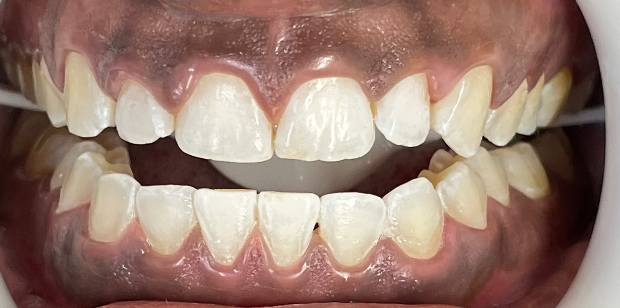 Crestview Family Dental Crestview Family Dental