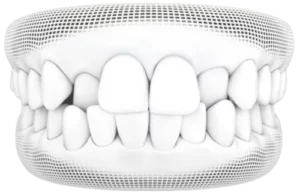 Dentist_Santa_Clara_CA service Dentist_Santa_Clara_CA service