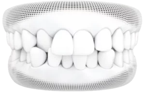 Dentist_Santa_Clara_CA service Dentist_Santa_Clara_CA service