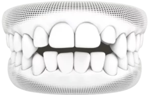 Dentist_Santa_Clara_CA service Dentist_Santa_Clara_CA service