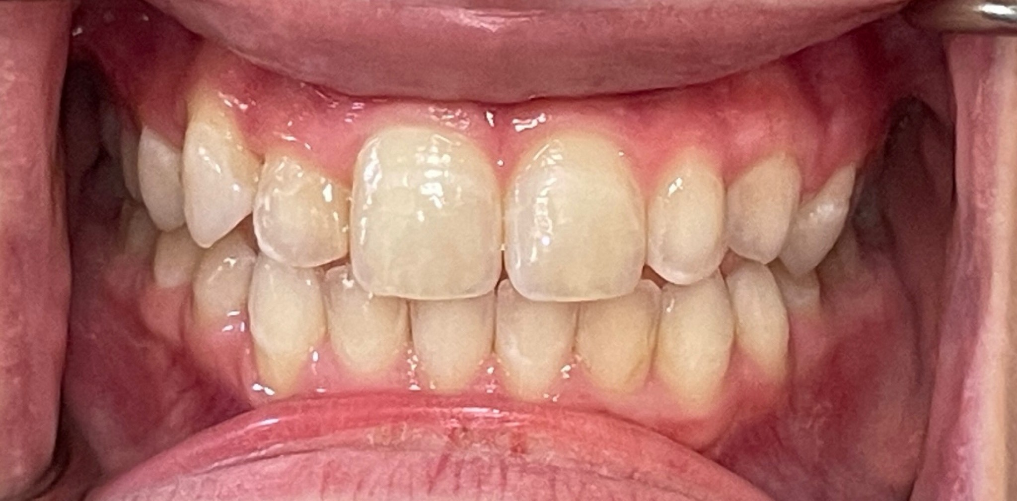 Crestview Family Dental Crestview Family Dental