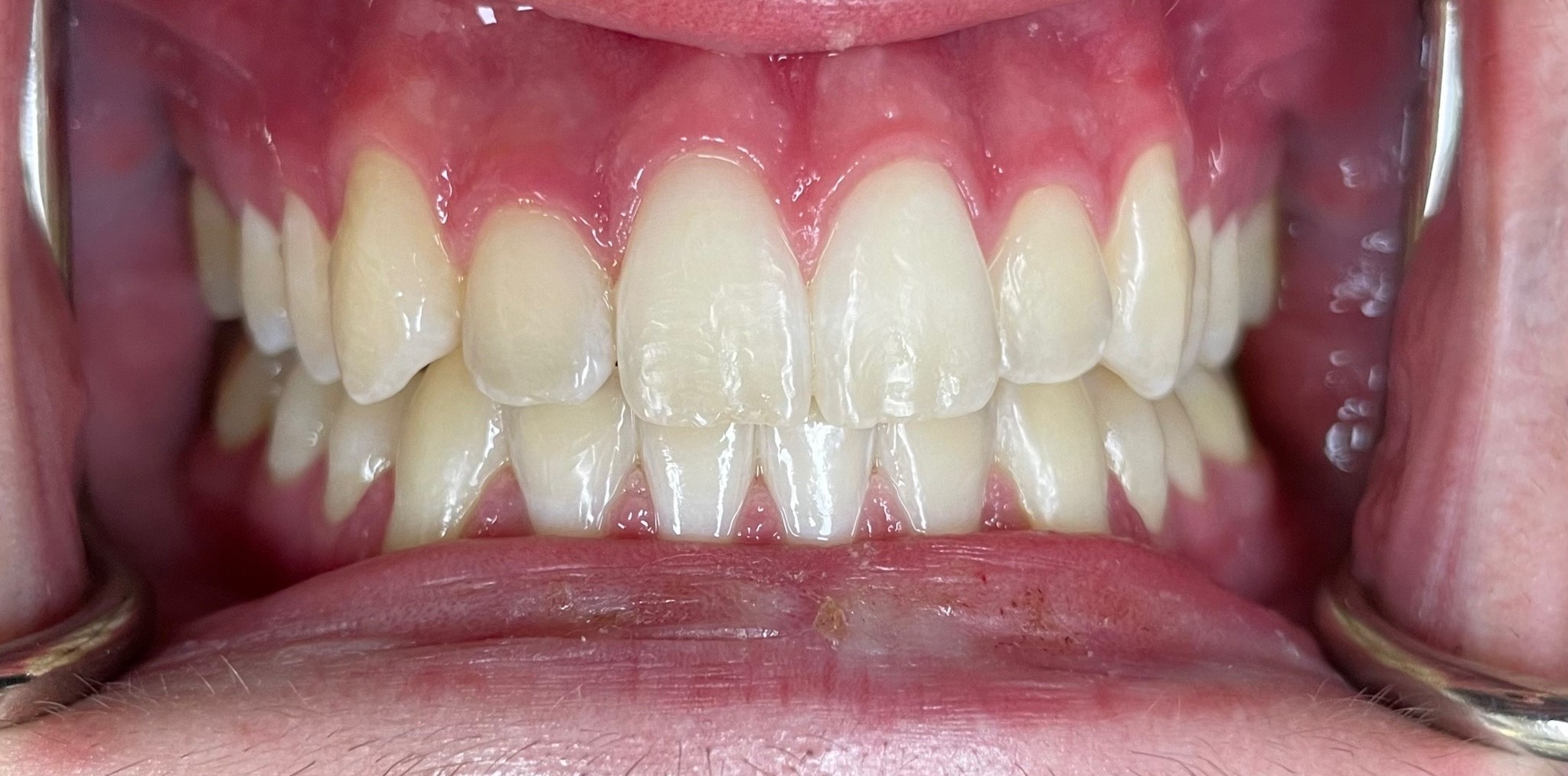 Crestview Family Dental Crestview Family Dental