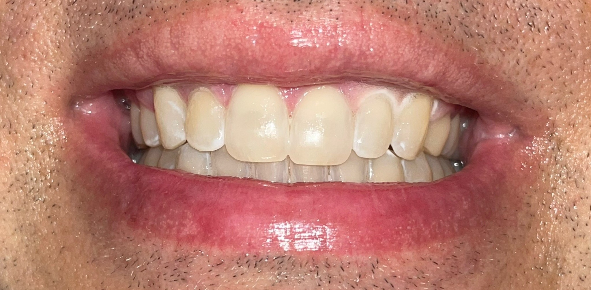 Crestview Family Dental Crestview Family Dental