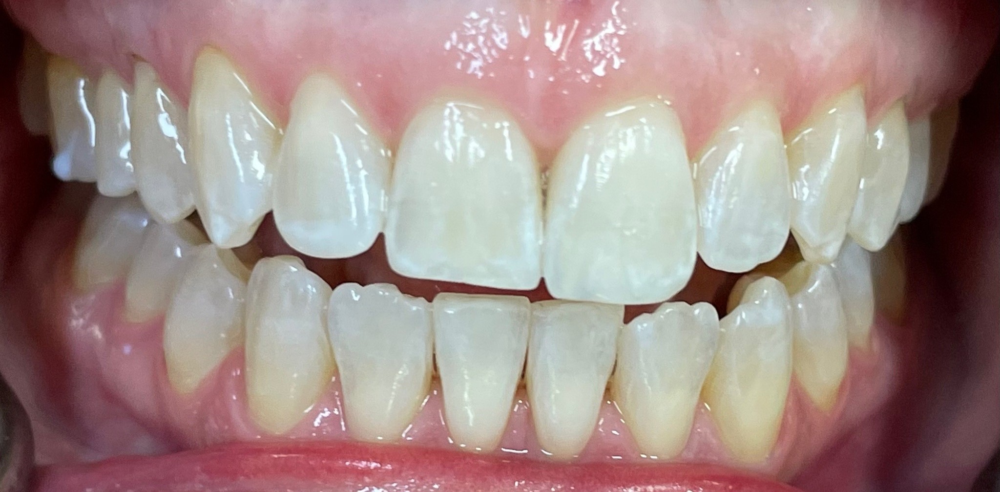 Crestview Family Dental Crestview Family Dental