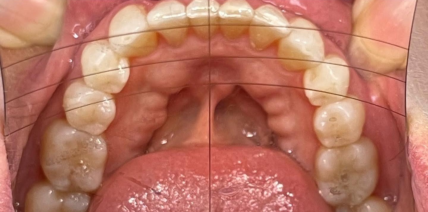 Crestview Family Dental Crestview Family Dental