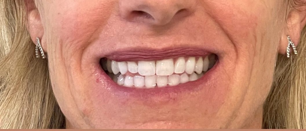 Crestview Family Dental Crestview Family Dental