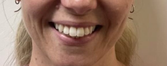 Crestview Family Dental Crestview Family Dental