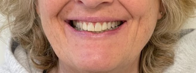 Crestview Family Dental Crestview Family Dental