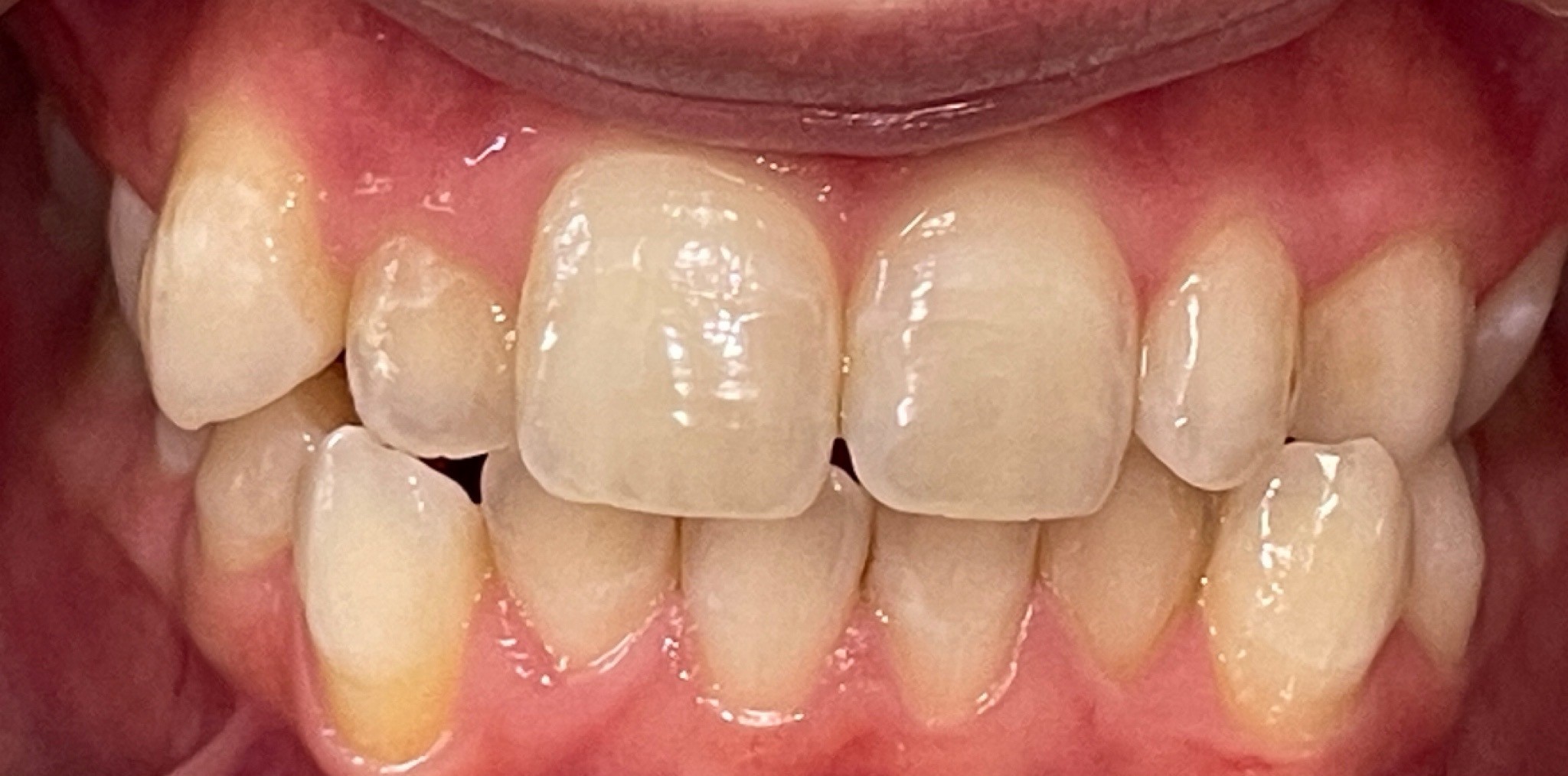 Crestview Family Dental Crestview Family Dental