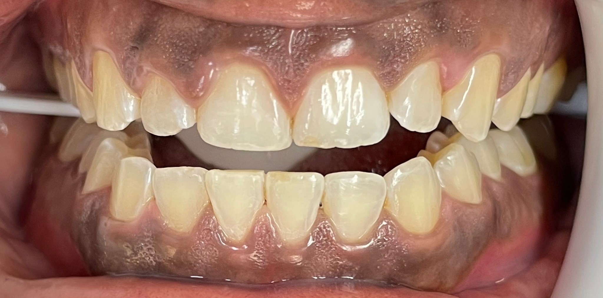 Crestview Family Dental Crestview Family Dental