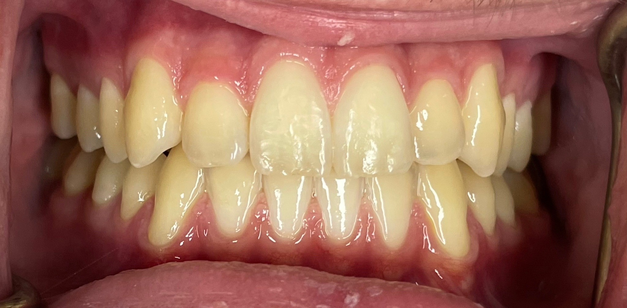 Crestview Family Dental Crestview Family Dental
