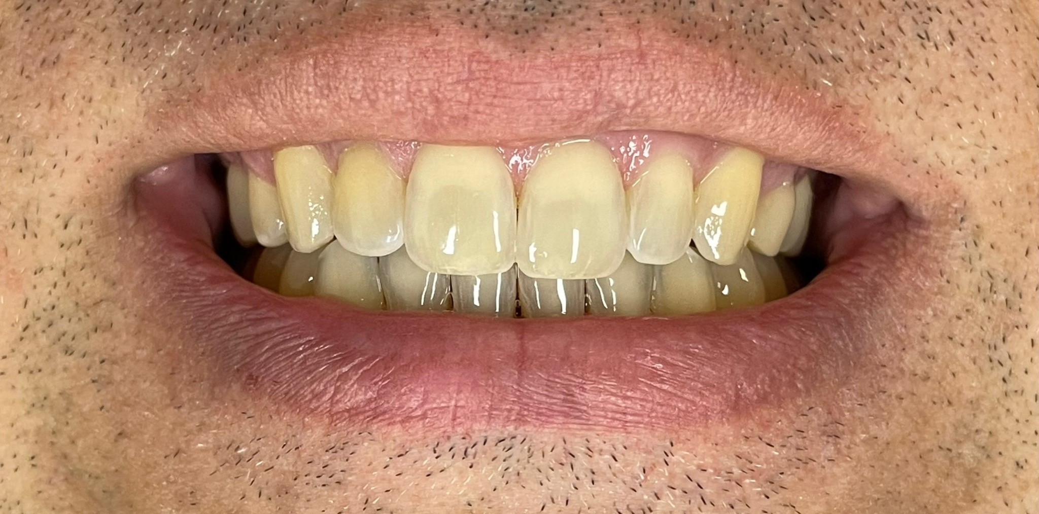 Crestview Family Dental Crestview Family Dental