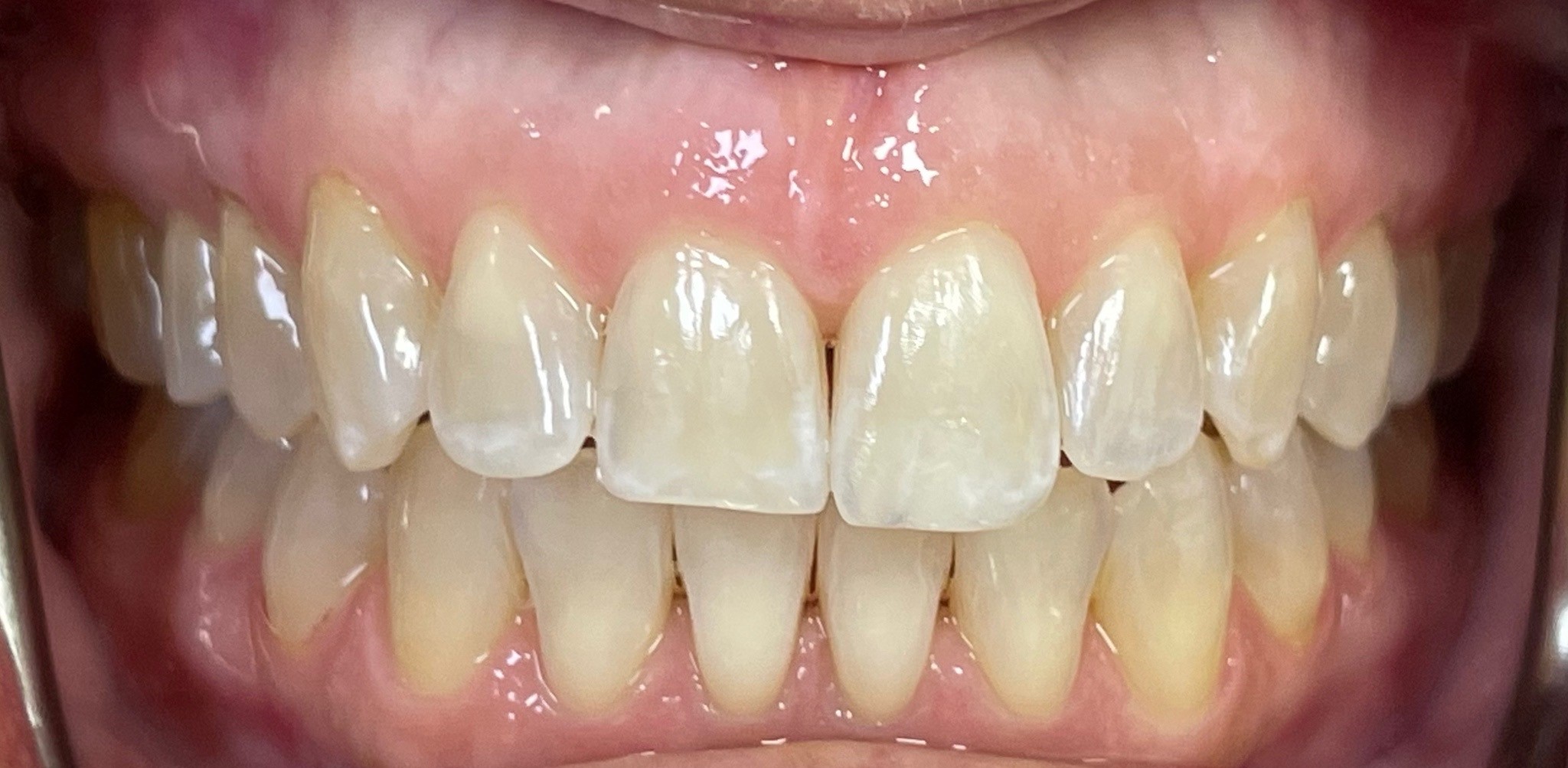 Crestview Family Dental Crestview Family Dental