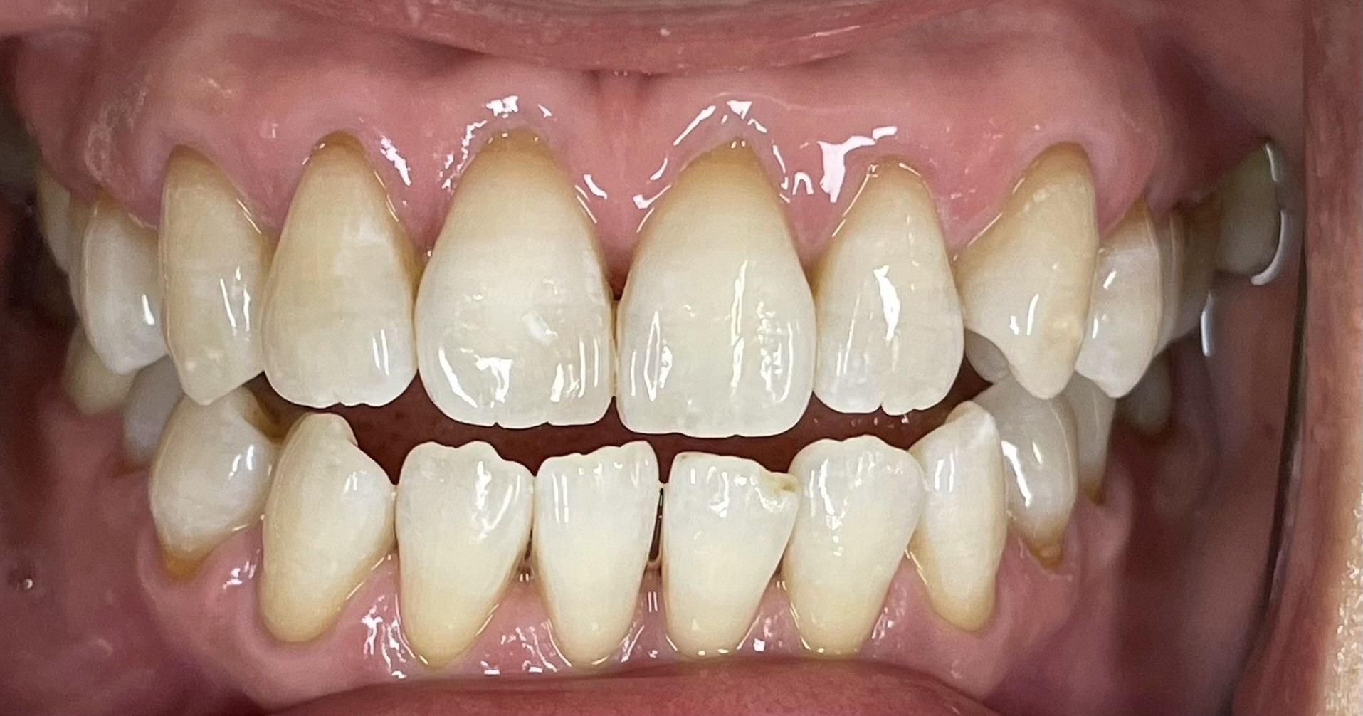 Crestview Family Dental Crestview Family Dental