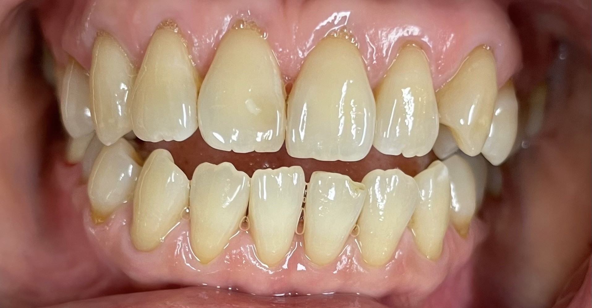 Crestview Family Dental Crestview Family Dental