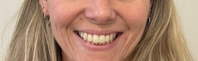 Crestview Family Dental Crestview Family Dental