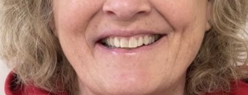 Crestview Family Dental Crestview Family Dental