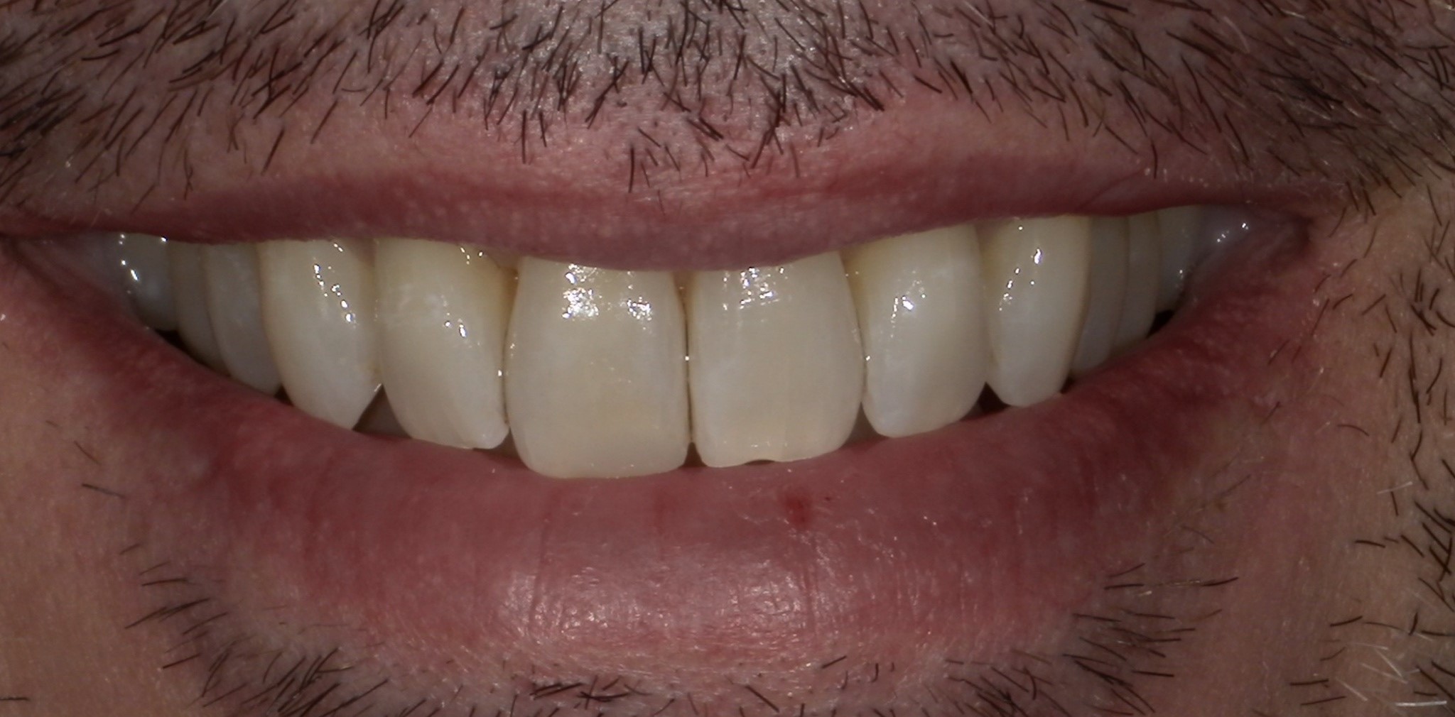 Crestview Family Dental Crestview Family Dental