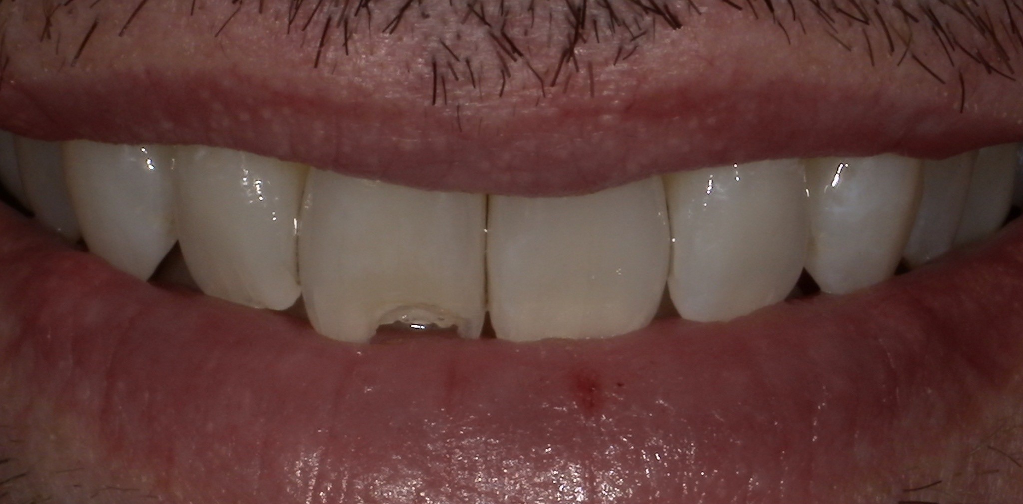 Crestview Family Dental Crestview Family Dental