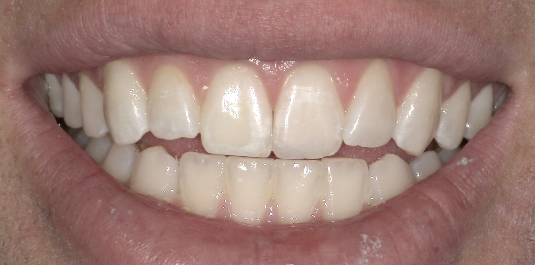 Crestview Family Dental Crestview Family Dental