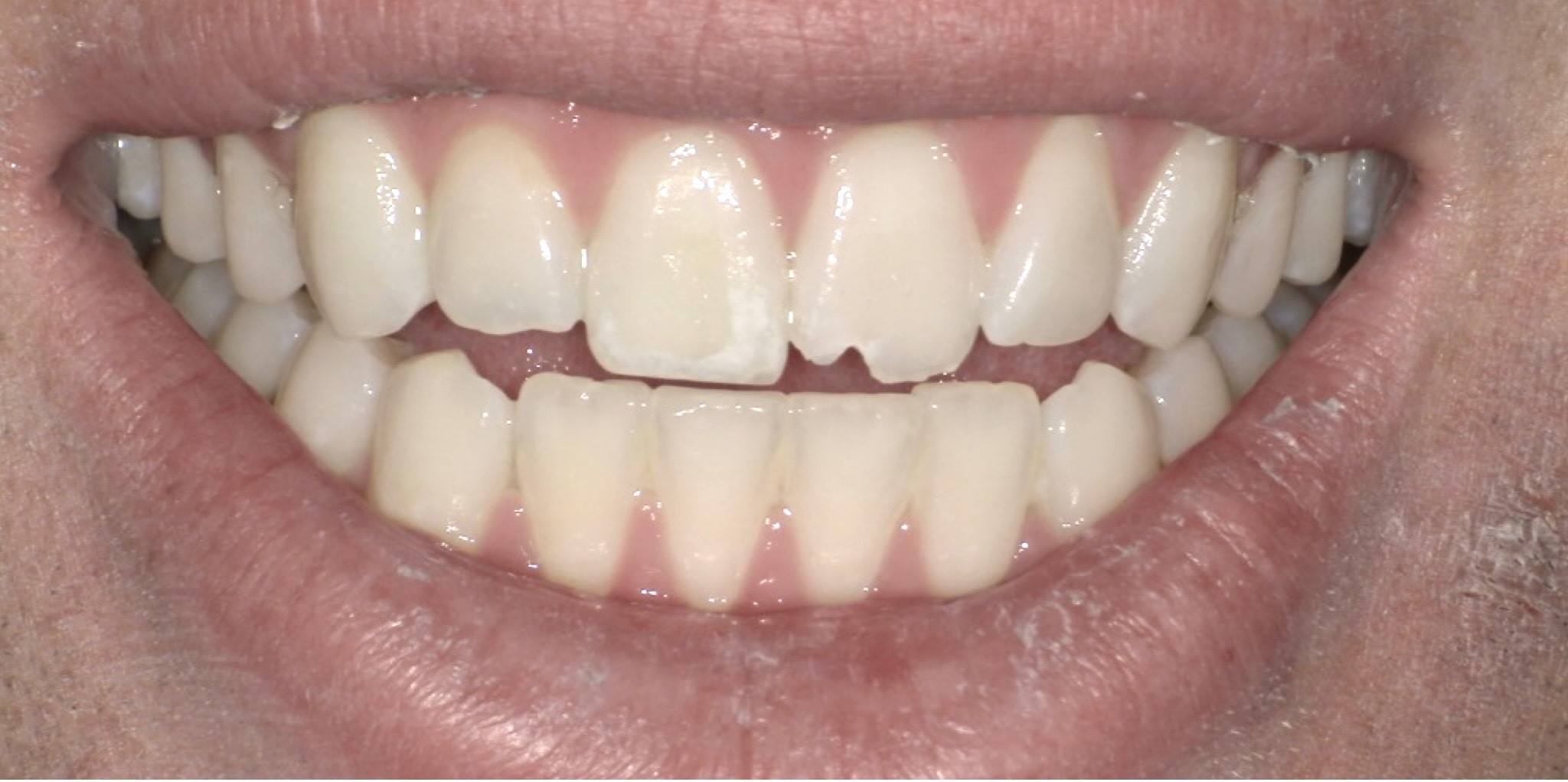 Crestview Family Dental Crestview Family Dental