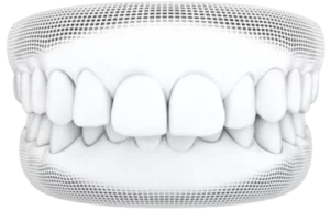 Dentist_Santa_Clara_CA service Rand Center for Dentistry